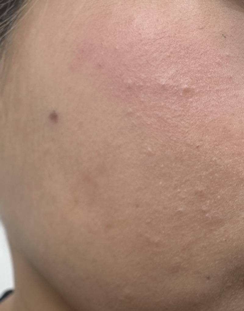 [잡담] 흑 피부 잘 아는사람 .. | 인스티즈