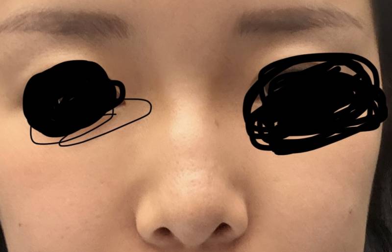 [잡담] 원래 이쁘징한 얼굴에서 트임이랑 코 히면 성 고 ㅣ될까? | 인스티즈