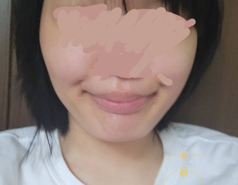[잡담] 땅콩형도 천천히 살 빼도 옆이 많이 꺼짐?? | 인스티즈