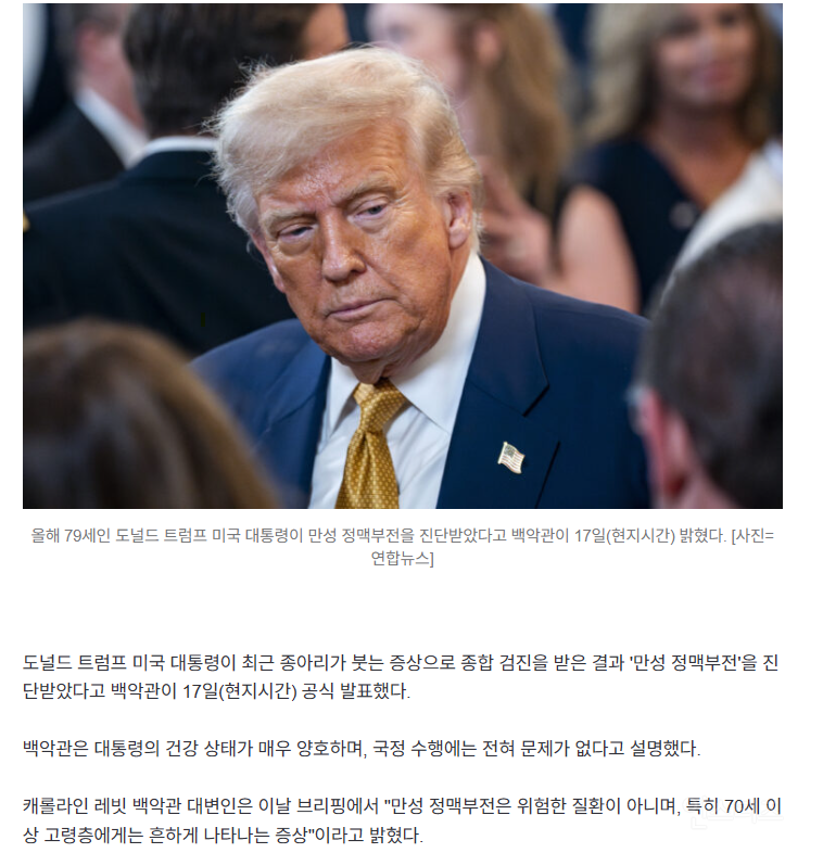 고령 트럼프 대통령, 다리 붓는 '만성 정맥부전' 진단 | 인스티즈