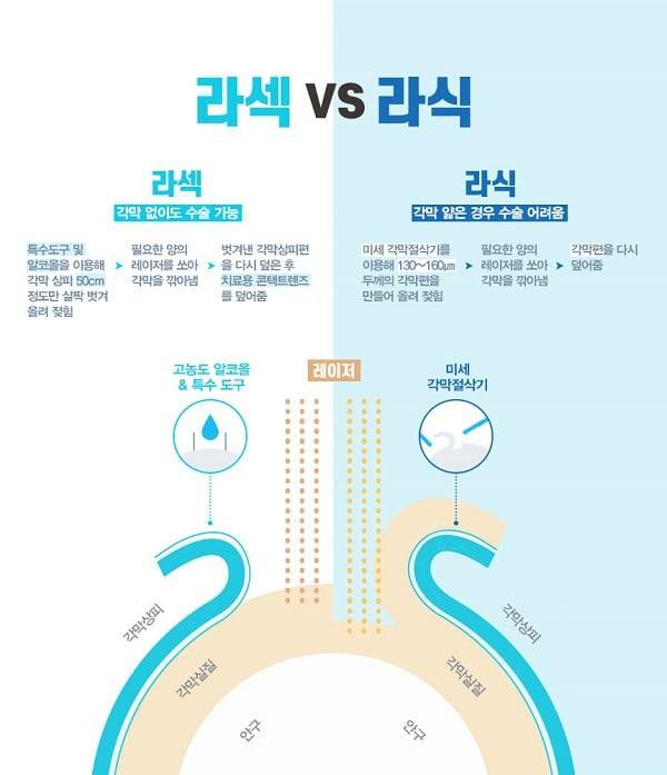 부작용 있다 없다로 30년째 논란인 수술.JPG | 인스티즈