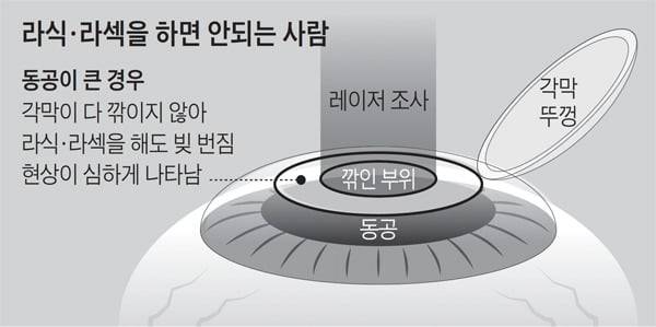 부작용 있다 없다로 30년째 논란인 수술.JPG | 인스티즈