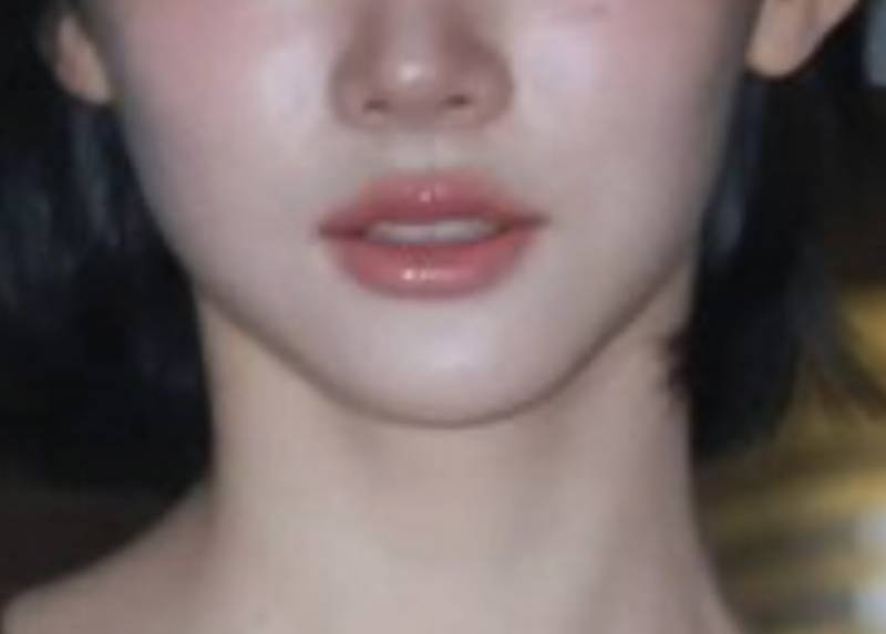 [잡담] 이런 턱 라인을 뭐라해..? | 인스티즈