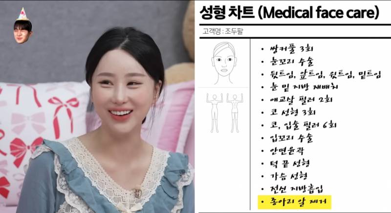 [잡담] 조두팔 ㄹㅇ성형체질인가봄 | 인스티즈