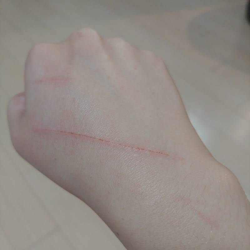 [잡담] 고양이가 할퀴었어ㅠㅠ(상처사진ㅇ) | 인스티즈