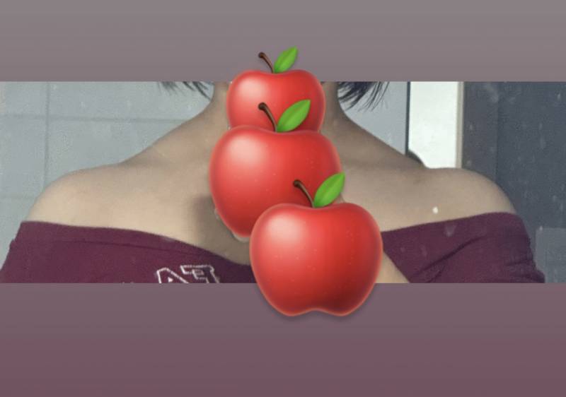 [잡담] 소생불가 내 승모근 | 인스티즈