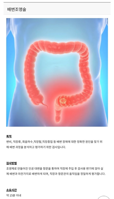 치질로 병원갔는데 ㄸ싸는 과정을 촬영해야 된대 | 인스티즈