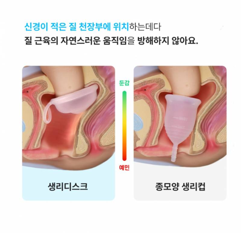 [잡담] 생리대->탐폰->생리컵->생리디스크로 넘어왔다 | 인스티즈