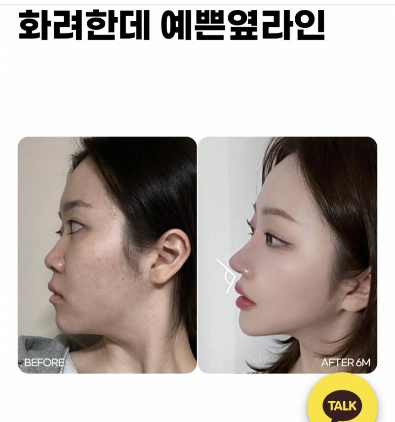 [잡담] (사진) 이거 눈, 코 말고 어디어디 성형한거야?? | 인스티즈