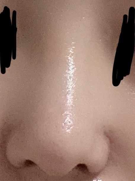 [잡담] 얘들아 이 코 성형코같냐 | 인스티즈