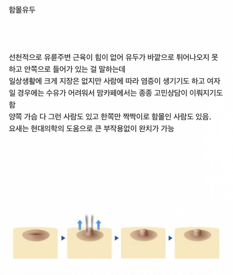우리나라 사람 100명중 3명 꼴로 가지고 있다는 신체특징 | 인스티즈