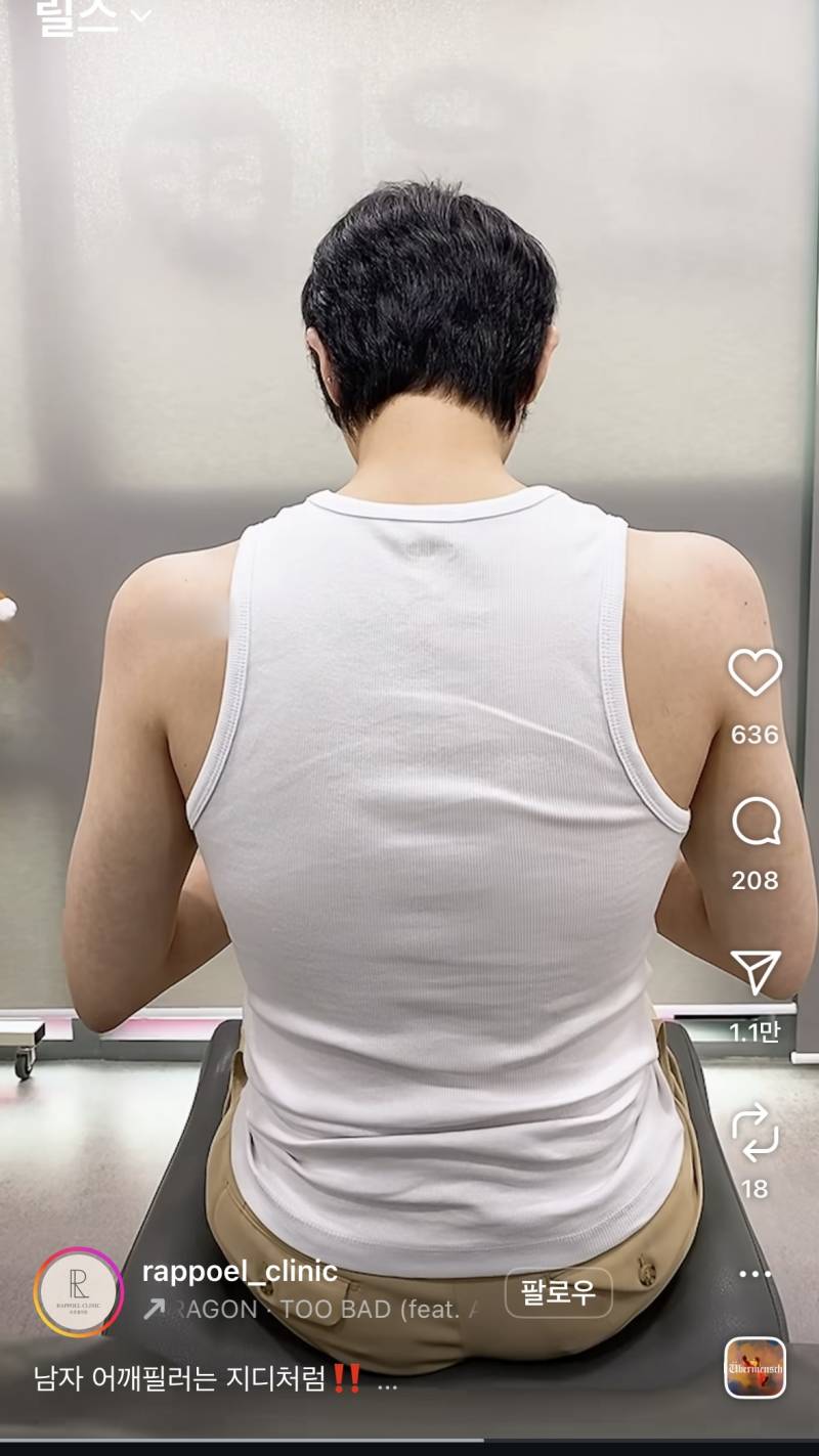 요즘 초인기라는 어깨 필러 전후..JPG | 인스티즈
