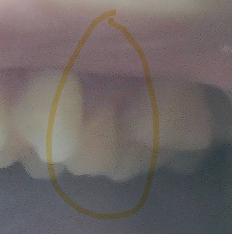 [잡담] 이빨 이거 좀 비정상이지?ㅠㅠ | 인스티즈