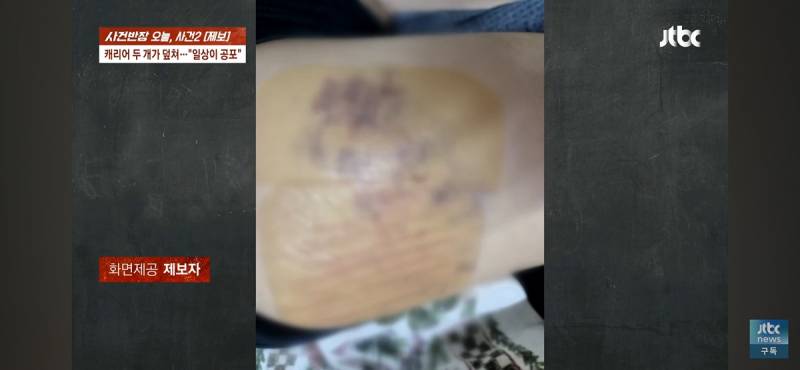 마곡나루역 에스컬레이터에서 굴러떨어진 캐리어 두개에 맞아 전치 8주.gi | 인스티즈