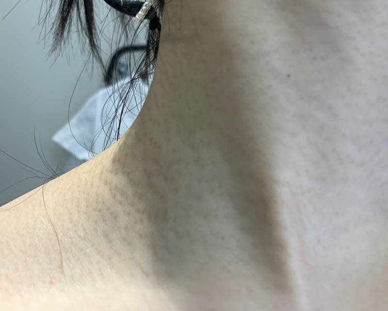 [잡담] 목 피부 더러운거 왜이러지? | 인스티즈
