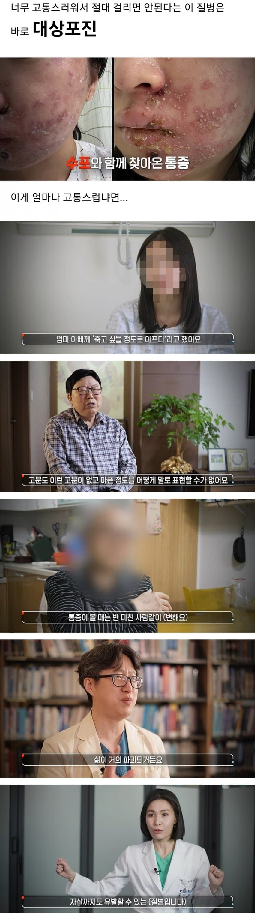 너무 아파서 절대 걸리면 안된다는 병.jpg | 인스티즈