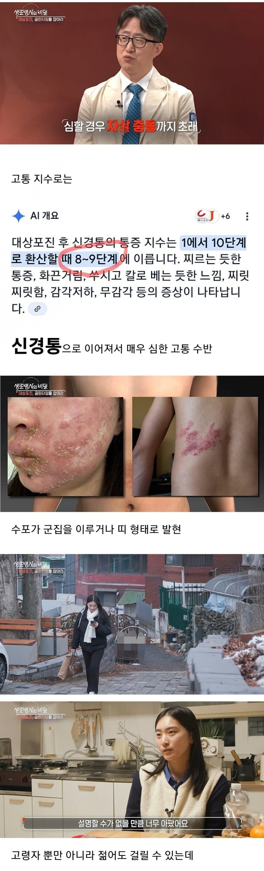 너무 아파서 절대 걸리면 안된다는 병.jpg | 인스티즈