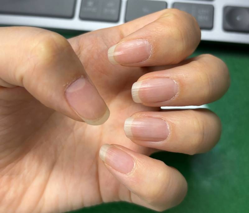 [잡담] 손톱길이 너무 지저분햐..? | 인스티즈