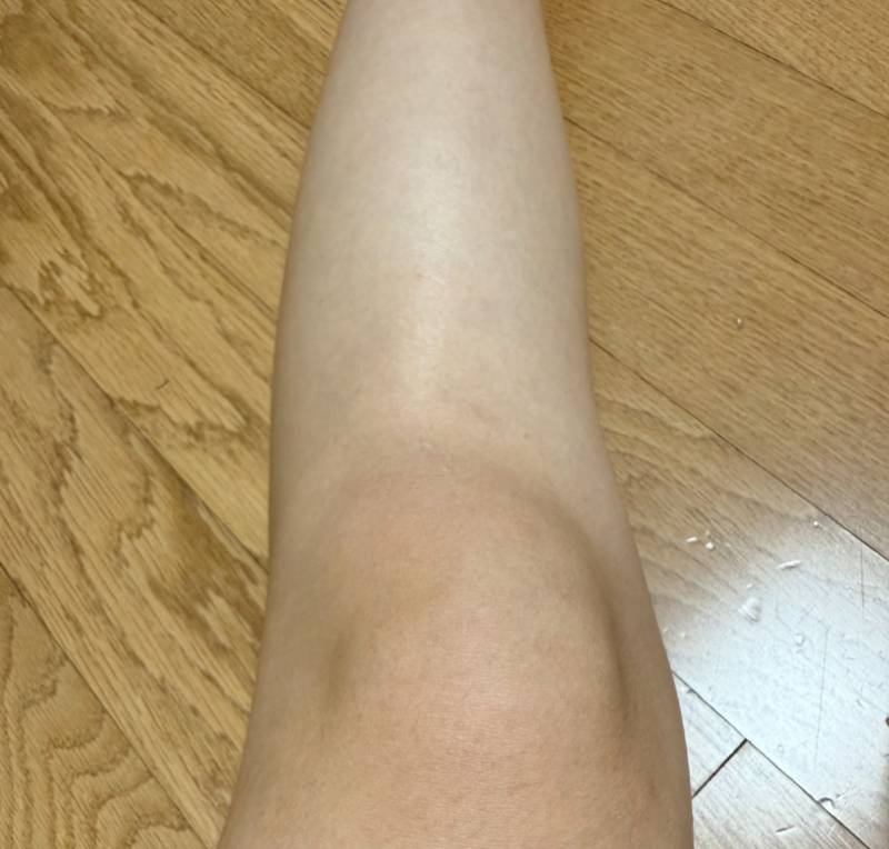 [잡담] 무릎위만탔어 종아리는 하얘 대체왜지 | 인스티즈