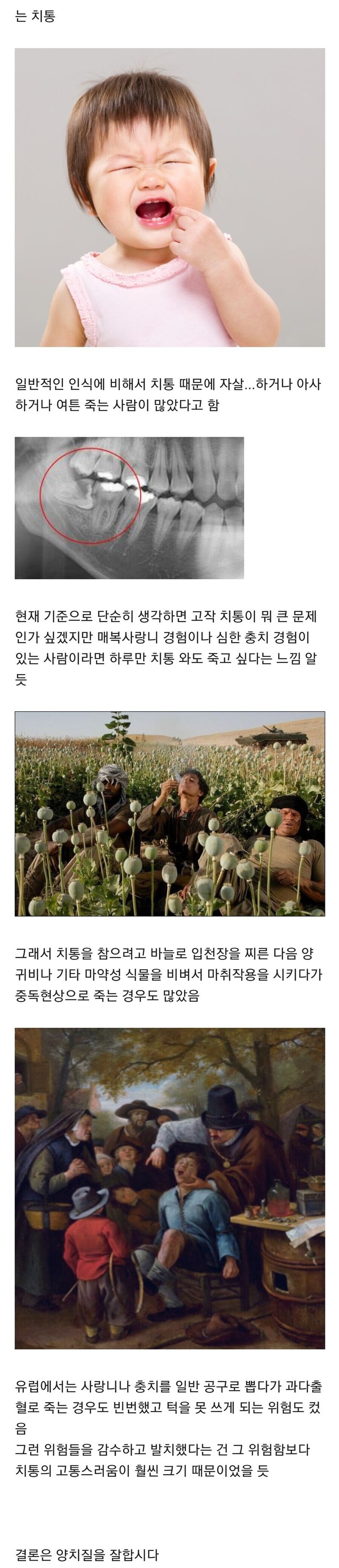 옛날 사람들도 버티기 힘들다는 고통.JPG | 인스티즈