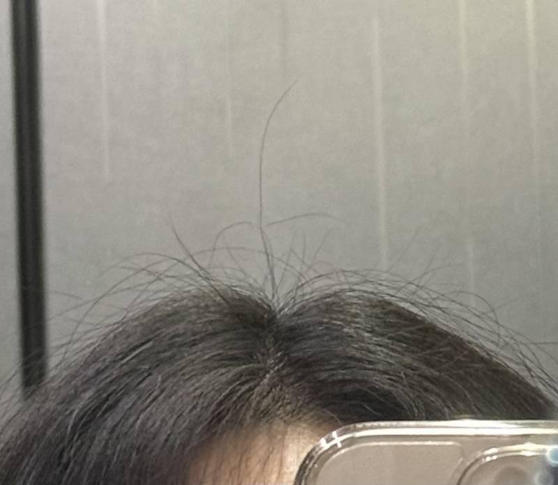 [잡담] 아 곱슬 여름에 미치것네 | 인스티즈