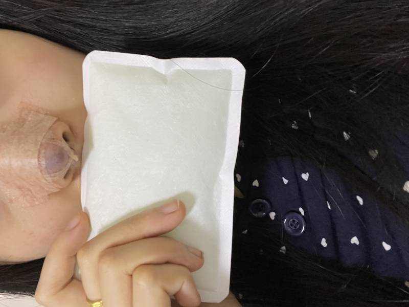 [잡담] 네번째 코수술 ... 힘들다 ㅋㅋ | 인스티즈