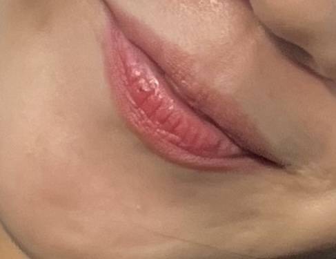 [잡담] 내 입술이랑 추구미입술인데... 필러로 가능해?? | 인스티즈