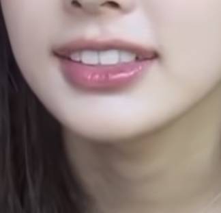 [잡담] 내 입술이랑 추구미입술인데... 필러로 가능해?? | 인스티즈