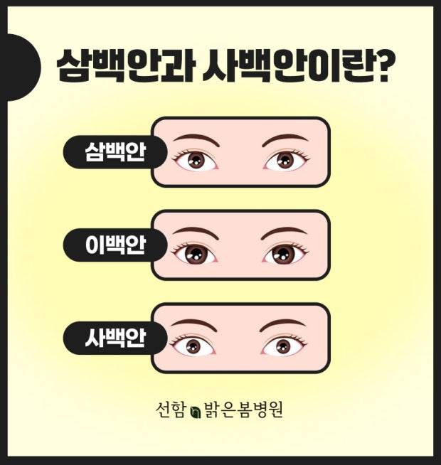 [잡담] 너네 사백안 가능해? | 인스티즈