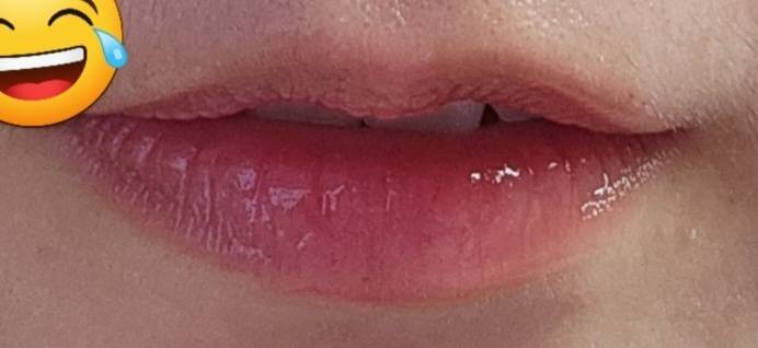 [잡담] 나보다 윗입술 없는 사람 나와보라그래... | 인스티즈