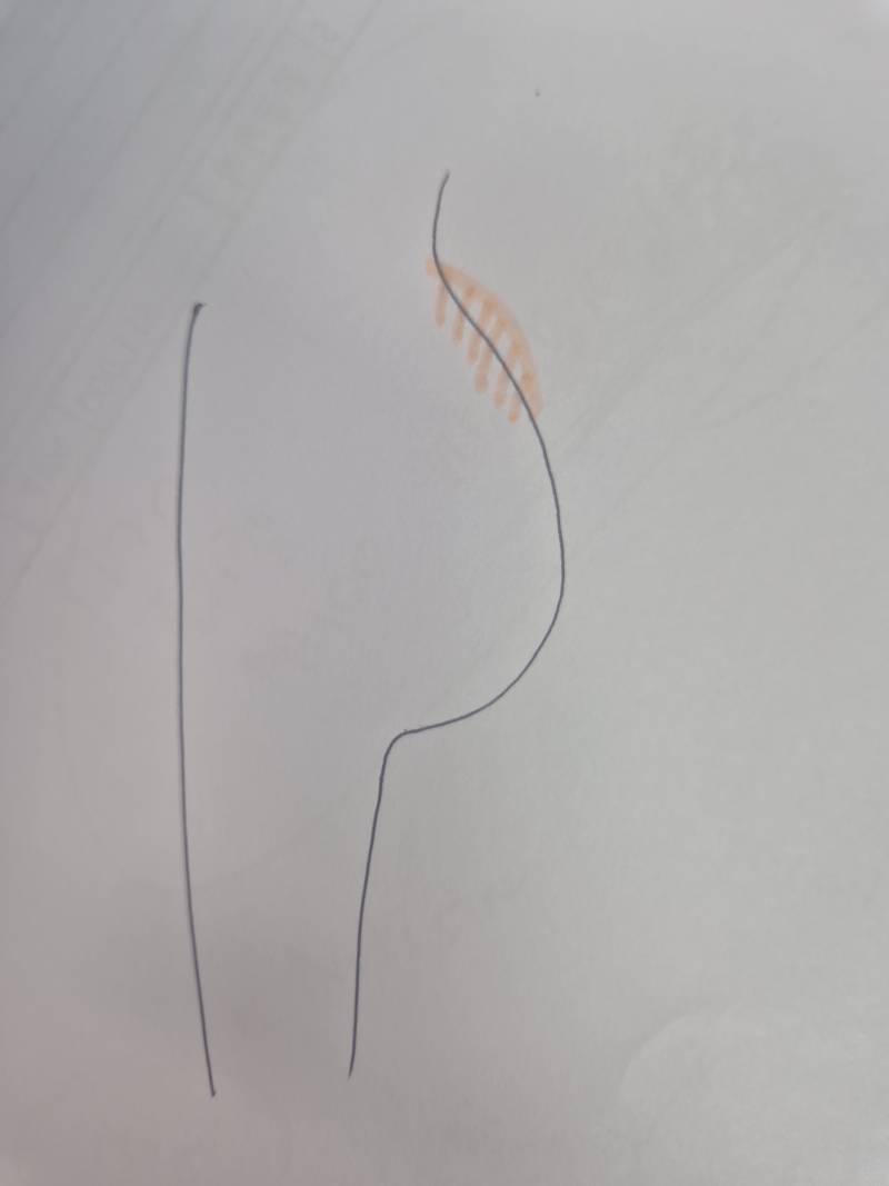 [잡담] 운동하는 익들아 내가 예쁜 힙을 가지고 싶은데 | 인스티즈