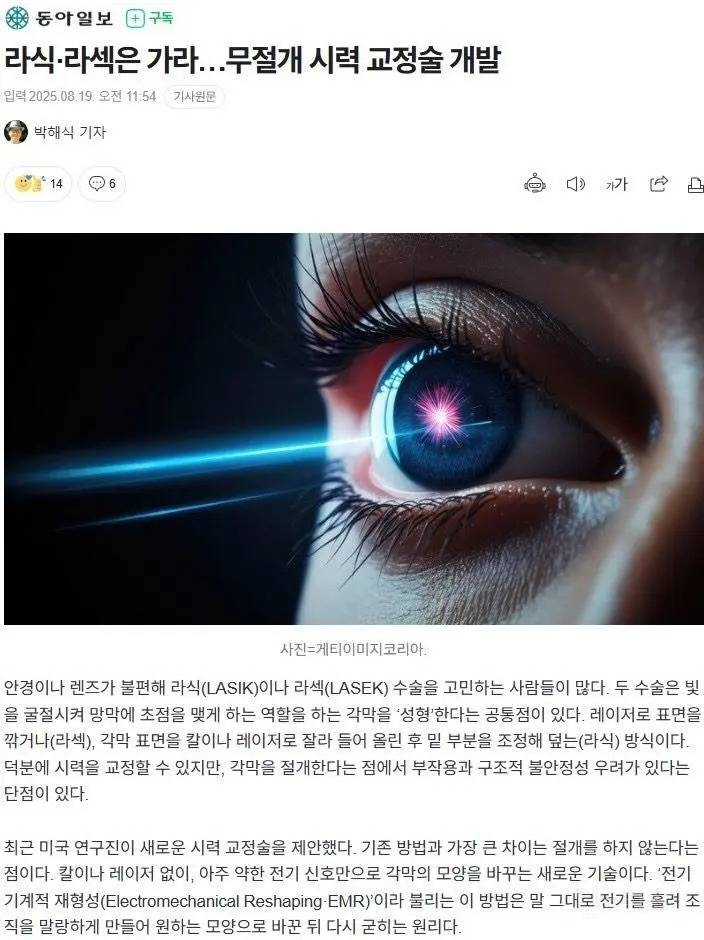 라식·라섹은 가라…무절개 시력 교정술 개발 | 인스티즈