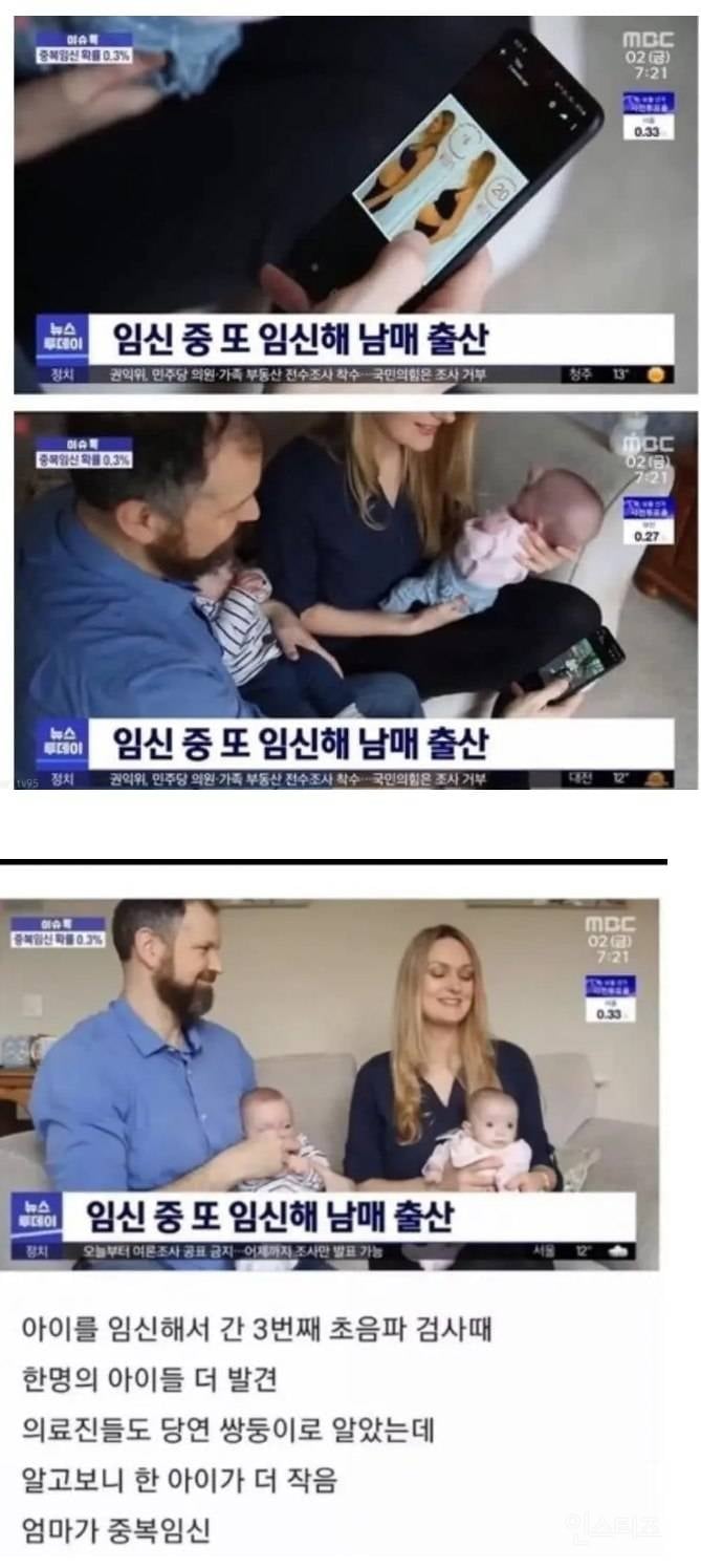매우 희귀하다는 임신 유형 .jpg | 인스티즈