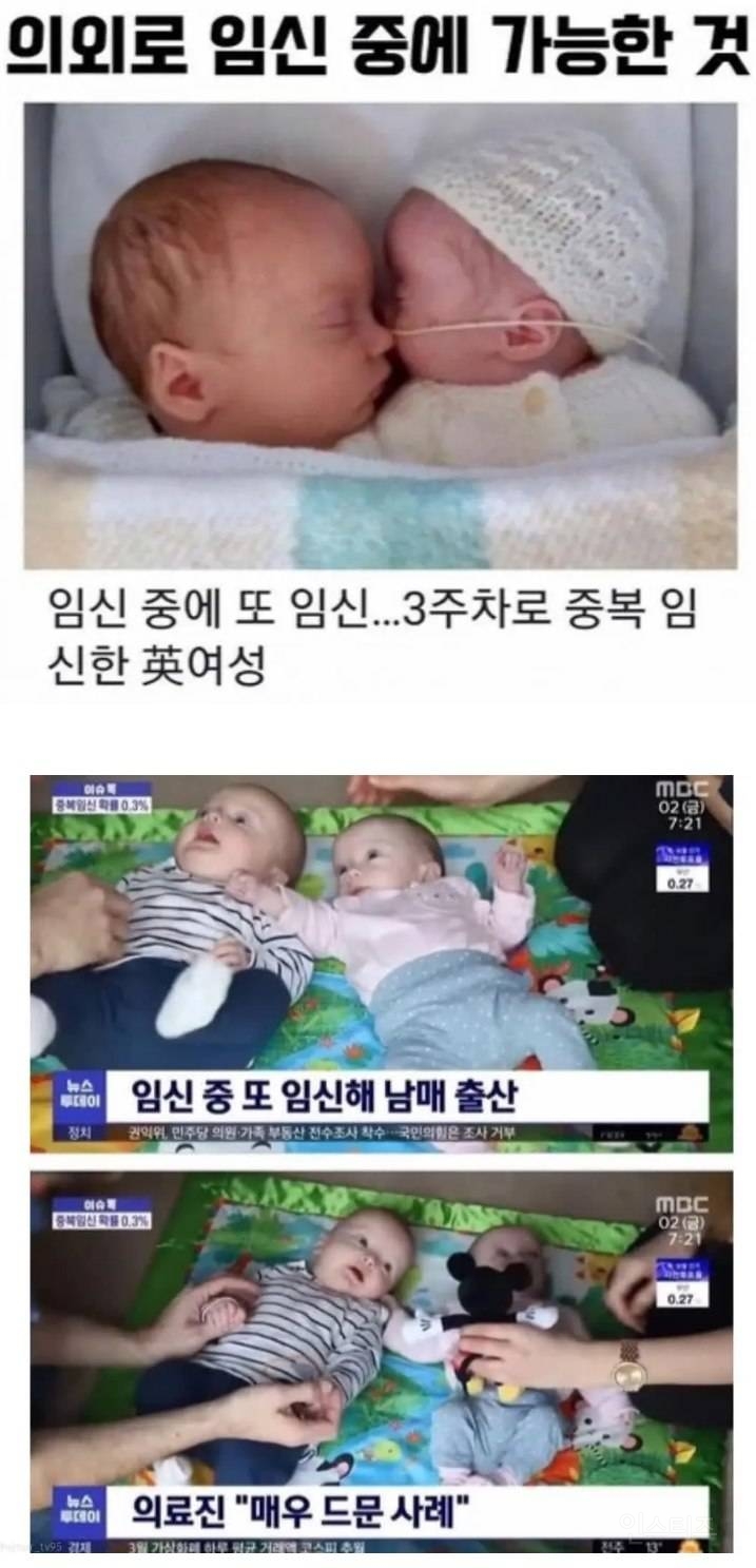 매우 희귀하다는 임신 유형 .jpg | 인스티즈