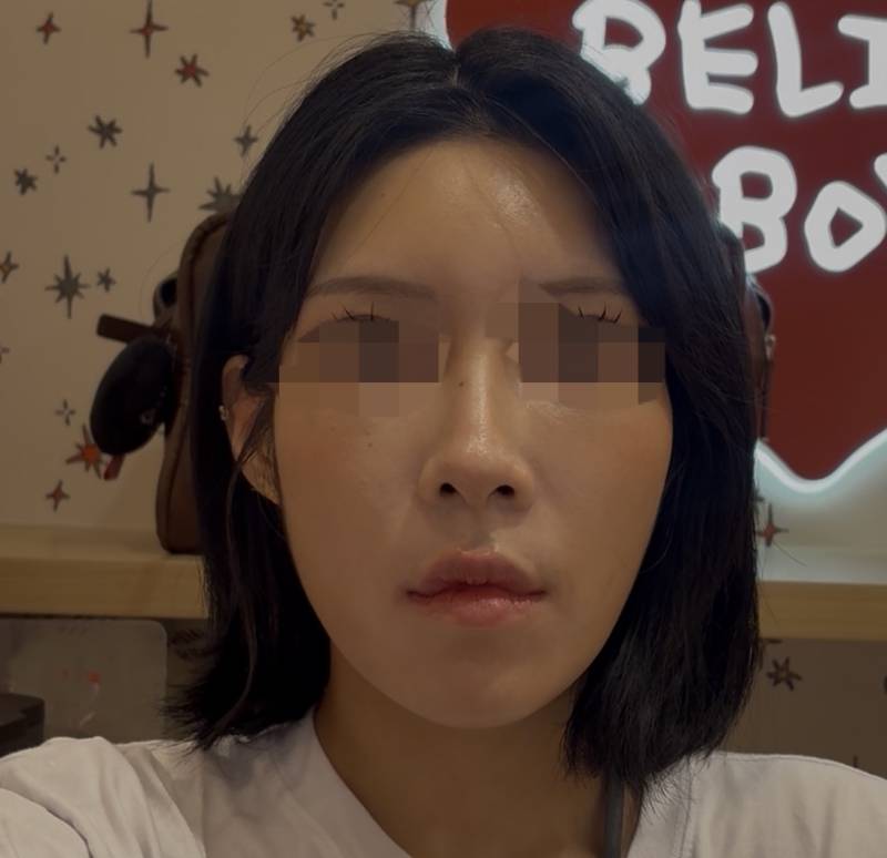 [잡담] 익들 후면카메라로 찍은 내얼굴형인데 긴오이상 같지 ..? | 인스티즈
