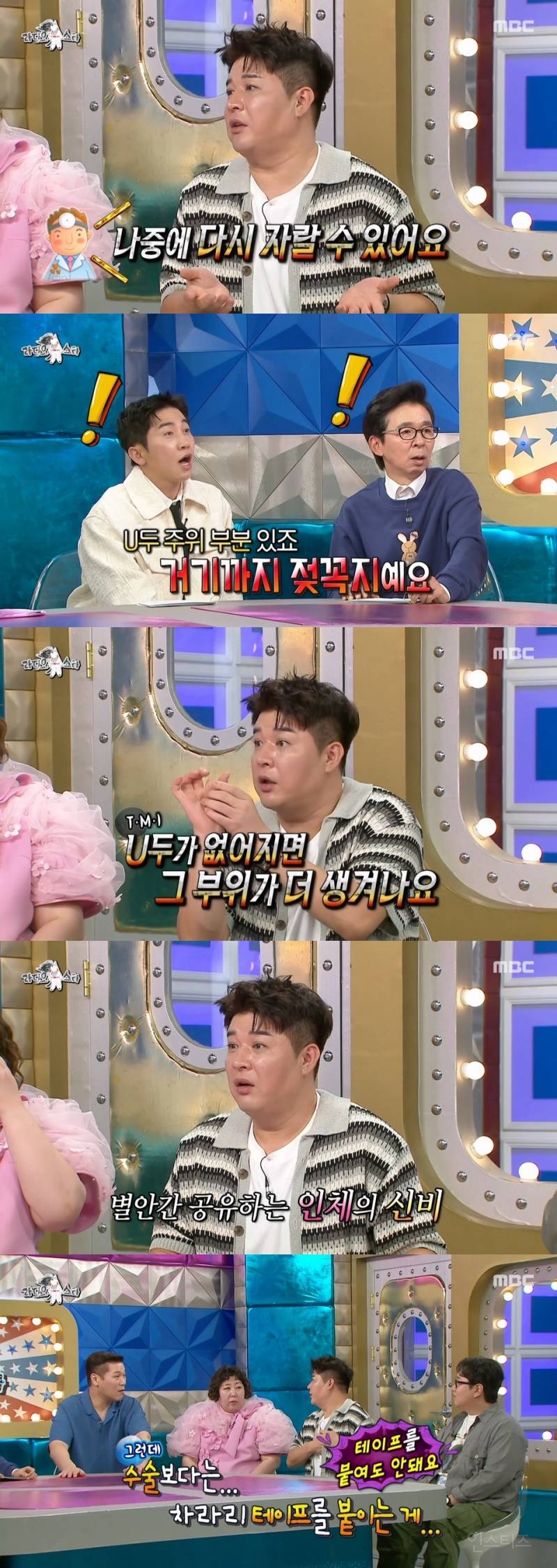 신동이 방송때문에 했다는 성형수술.jpg | 인스티즈