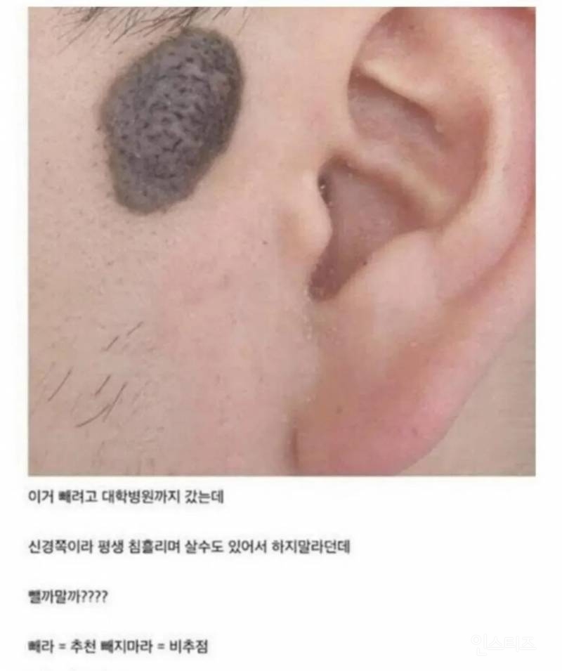 이거 빼면 평생 침흘리고 살 수도 있다는데.jpg | 인스티즈