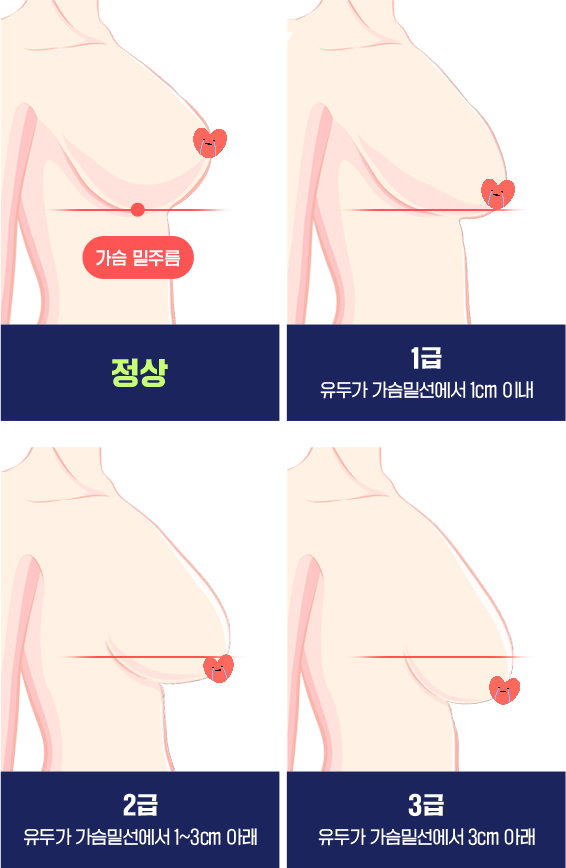 [잡담] 4정도로 꼭지쓰가 아래에 있는 사람이 있음..? | 인스티즈