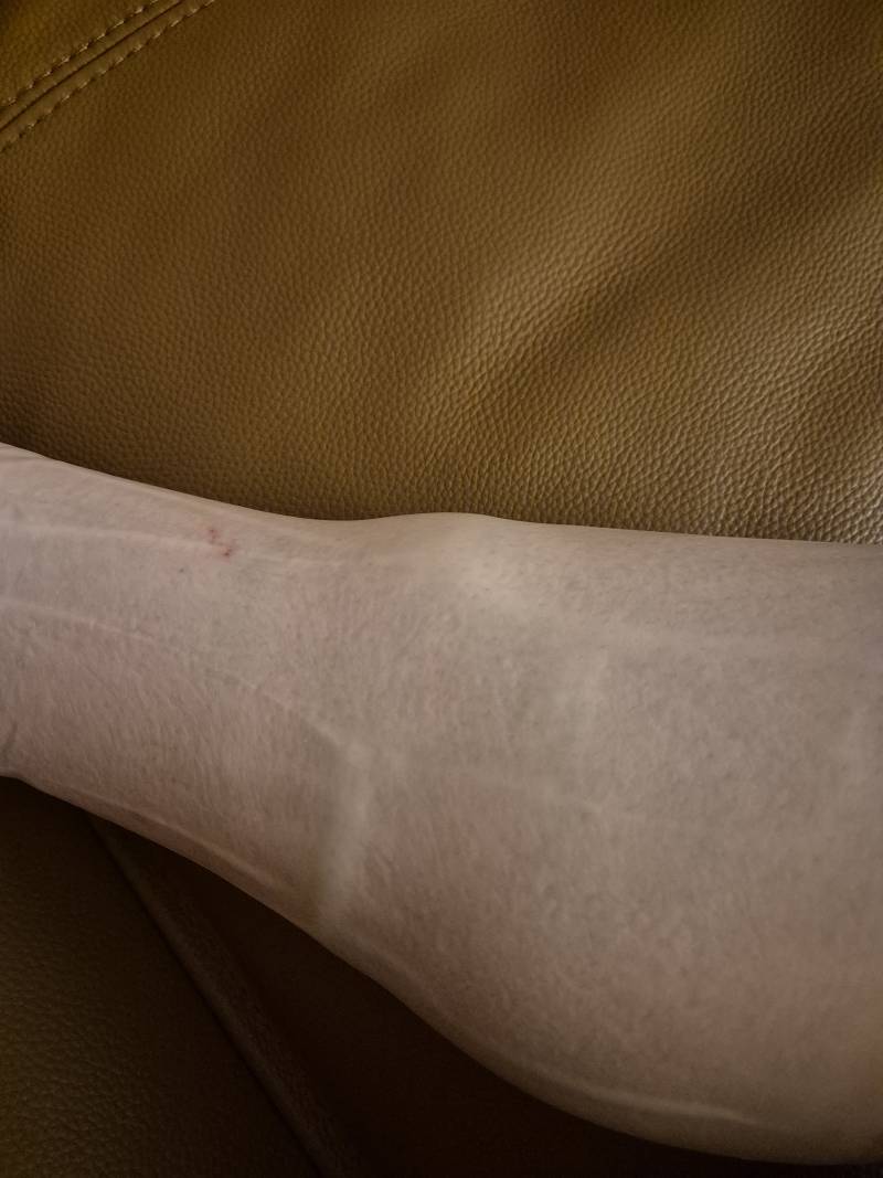 [잡담] 부은 다리 종아리 마사지기 한거 봐 | 인스티즈