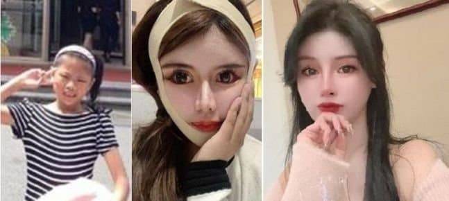 [잡담] 성형수술에 6억 8천 쓴 중국인이래 | 인스티즈