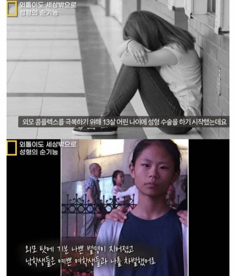 [잡담] 성형수술에 6억 8천 쓴 중국인이래 | 인스티즈