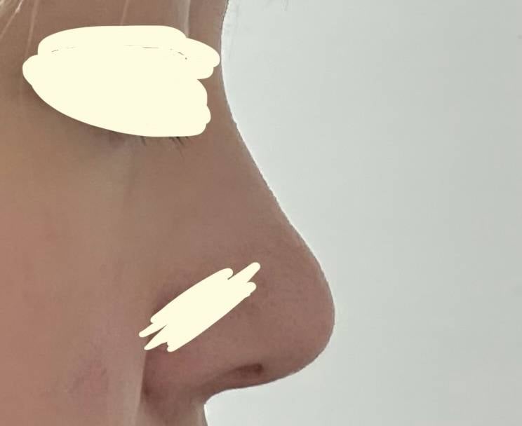 [잡담] 내 코 자연같아 성형같아?? | 인스티즈