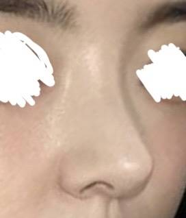 [잡담] 나 코 정면은 엄청 낮아보이지ㅋㅋㅋㅋ | 인스티즈