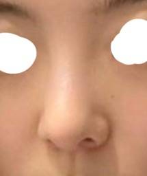 [잡담] 나 코 정면은 엄청 낮아보이지ㅋㅋㅋㅋ | 인스티즈