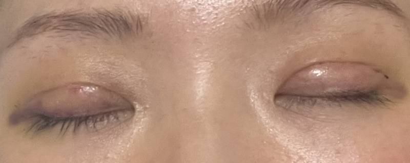 [잡담] 붓기빠지면 라인 어떻게 될 거 같아??? | 인스티즈