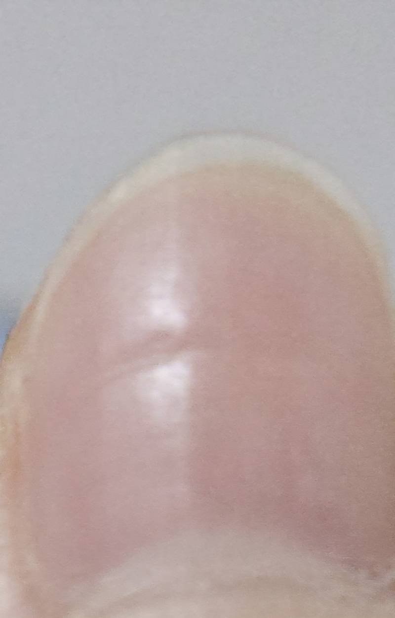 [잡담] 오른손 엄지손톱인데..가로패임 심해? | 인스티즈