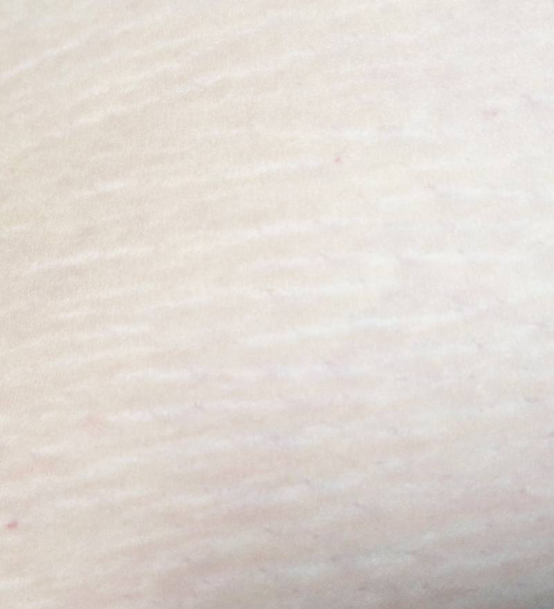 [잡담] 피부 이건 ㄹㅇ 노답이지? | 인스티즈