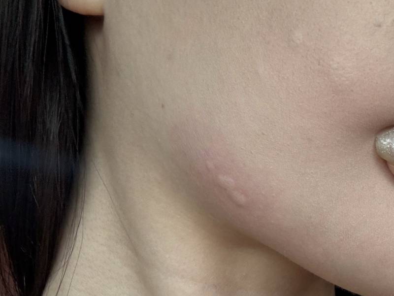 [잡담] 간장게장 먹고 피부 이뤃게 됨.......... | 인스티즈