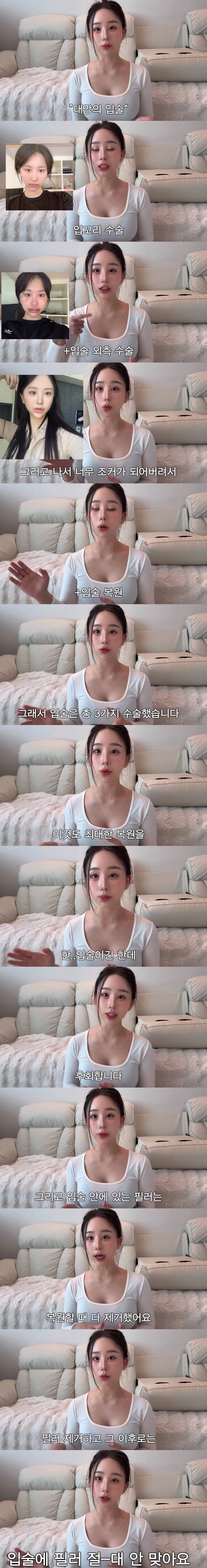 현재 중2때부터 한 수술 다 까발린 조두팔..JPG | 인스티즈