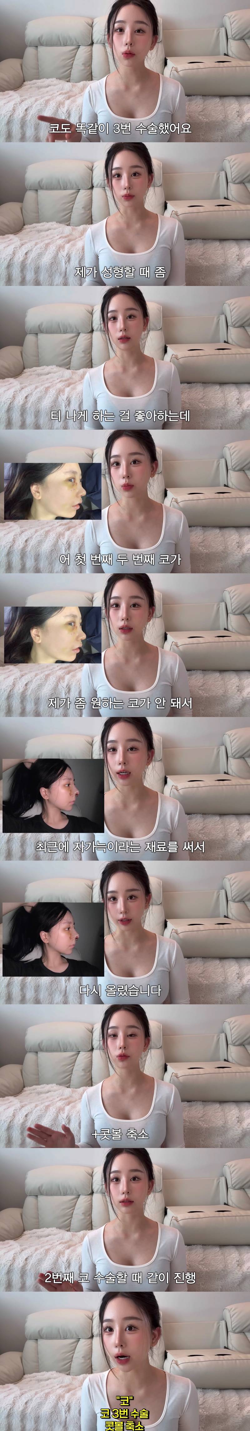 현재 중2때부터 한 수술 다 까발린 조두팔..JPG | 인스티즈